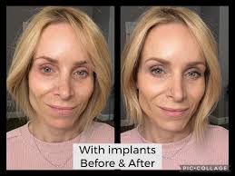 Considering the original post and the criteria, here is a rewritten summary  that captures the essence of the post in a concise and searchable manner