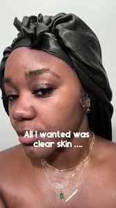 Natural Remedies for Clear Skin: Effective Tips