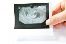 Cheguei Ao Mundo Fernanda Rodrigues Sobre Gravidez Bebes E Maternidade Arquivos Gravidez Semana A Semana 5 Semanas Cheguei Ao Mundo Fernanda Rodrigues Sobre Gravidez Bebes E Maternidade