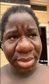 Pregnancy experiences vary greatly