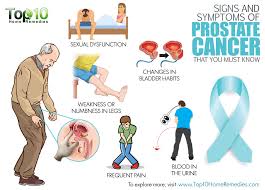 In fact, most people don't even know what it does. Prostate Cancer Symptomsjpg Medcare Spainmedcare Spain