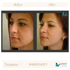 Malcolm Lesavoy's Instagram, Twitter & Facebook