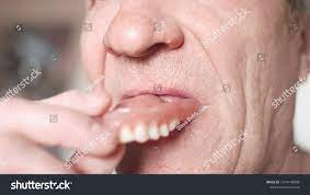 Mouth Elderly Man False Teeth Older Stock Photo 1514178008 | Shutterstock