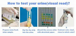 Bayer Urine Test Strips Buy Urine Protein Test Strip Urine Occult Blood Test Strip Urine Microalbumin Test Strip Product On Alibaba Com