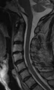 Are just guidelines for the provision of specialty health services. Spine Mri Quick Reference Guide For Physicians