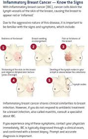 Image result for Inflammatory breast cancer