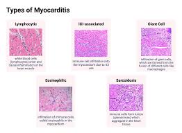 Image result for Myocarditis