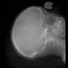 For all its faults, florida's got some serious benefits for full time rvers. Big Changes For Health Insurance Options Rv Life