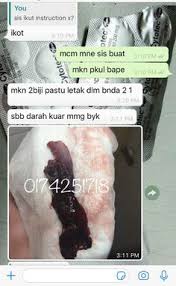 Ambillah 2 batang kunyit sepanjang tiga sentimeter sebesar jari kelingking. 13 Dr Gugur Kandungan Ideas Doctor Bape T Shirts For Women