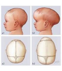 2010 Group Project 2 Embryology Pediatry Kids Health Neonatal Nurse