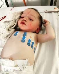 My baby had same rare disease as Mrs Hinch's son