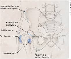 Iliac crest pain can spread to other parts of the body. Hip Pain In Athletes American Family Physician