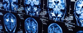 How much does a neuro surgeon make. A Day In The Life Of A Neurologist And Neurosurgeon The Apprentice Doctor