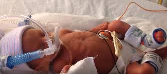 6 Good Prayers For Preemies Connectus