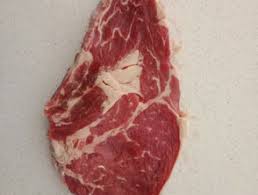 Tick Bite Induced Red Meat Allergy Dermnet Nz