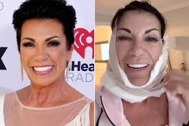 Golden Bachelor”'s Susan Noles, 67, Gets a Breast Reduction and Lower  Facelift, Joining Pal Kathy Swarts