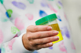 Dark Yellow Urine In Pregnancy Lovetoknow