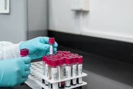 Viajeros deben presentar prueba pcr negativa para entrar a colombia. Pcr Y Test De Anticuerpos Para La Lucha Contra La Covid 19 En Asturias Imoma Instituto De Medicina Oncologica Y Molecular De Asturias