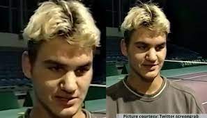 Fue leaves the hair looking thinner and sparser in the back area. Roger Federer Makes Fans Nostalgic After Sporting Blonde Hair In 1999 Interview Watch