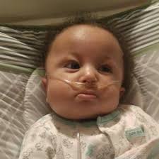 Danica's Hope with Trisomy 18