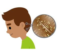 Eran Finkle CC BY Gilles San Martin CC BY-SA