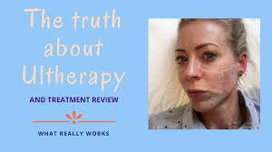 The prices are pretty steep! The Truth About Ultherapy Alice Hart Davis Youtube