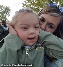 Model with Down syndrome stars in new American Girl catalog