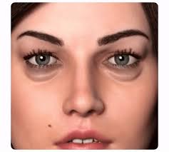 flysmus™ Krema għat-Tiswija u l-Irfigħ tal-Għajnejn CaffeineEYES