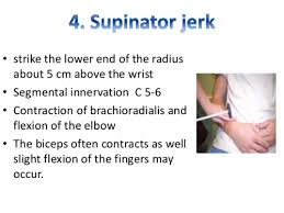 Image result for Supinator Reflex