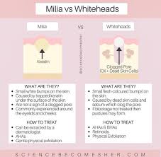 White bumps on face may be caused by sun exposure, milia spots or whiteheads. Dermalogist Beauty Therapy Dr Murad Dermalogica Serusop Brunei Milia Vs Whiteheads Milia Are Small White Bumps On The Skin That May Be Confused For Acne However They Are Caused By