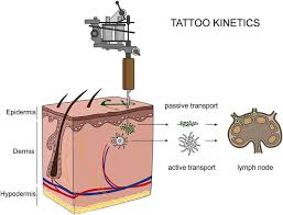 But there's surprisingly little research into whether tattoos — once the domain of sailors and pirates — increase a person's risk of developing skin cancer within the tattoo. Translocation Of Tattoo Particles From Skin To Lymph Nodes Upon Download Scientific Diagram