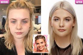 David schwimmer is very famous as a director and producer. I Had A 4k Love Island Makeover At 21 Including Jawline Botox And Lip Fillers And The Results Are Quite Literally Jaw Dropping My Style News