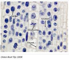 Maybe you would like to learn more about one of these? Solved Experiment 1 Observation Of Mitosis In A Plant Cell In This 1 Answer Transtutors