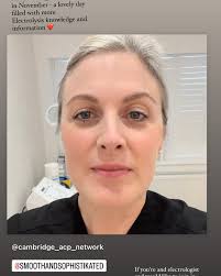 Intimate waxing & blemish removal, Leighton Buzzard  (@smoothandsophistikated) • Instagram photos and videos