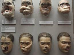 Pin On Medical Oddities