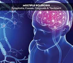 Oct 05, 2020 · the impact of treatment with actemra on demyelinating disorders is not known, but multiple sclerosis and chronic inflammatory demyelinating polyneuropathy were reported rarely in ra clinical studies. Multiple Sclerosis Symptoms Causes Diagnosis Treatment