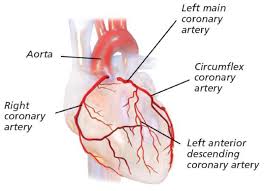 Maybe you would like to learn more about one of these? Your Coronary Angiogram And Coronary Angioplasty Chelsea And Westminster Hospital Nhs Foundation Trust