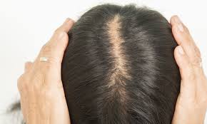A good shag haircut for thin hair is like your best fitting dress: Female Hair Loss Thinning Hair Women Hair Skin Science
