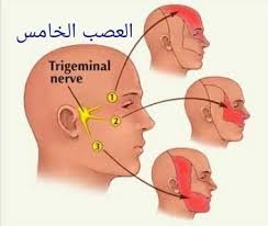 علاج العصب الخامس بالحجامة يحدث التهاب كيف نفهم الحجامة في ضوء الطب الصيني Facebook