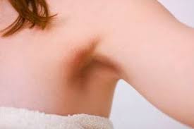 Koltukalti Kararmasi Turuncukasa Blog Kozmetik Makyaj Ve Fazlasi