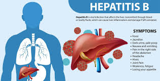 Image result for hepatitis symptoms