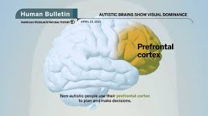 .advances and genetic research that link brain science to behavior—all leading to a route toward more effective mainstreaming and a way to unleash the unique advantages of autistic people. Science Bulletins Autistic Brains Show Visual Dominance Youtube
