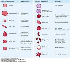Overview Of The Anemias Pathophysiology Of Blood Disorders