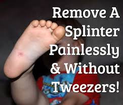Remove A Splinter Without Tweezers Splinter Removal How To Remove Good To Know