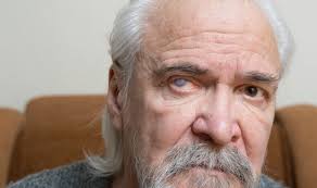 At least a million Brits suffering little-known condition that causes scary  hallucinations