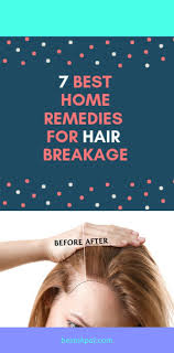 Kirkland Minoxidil Pictured Is 2 Oz Hair Loss Solutions Home Remedies For Hair Hair Loss