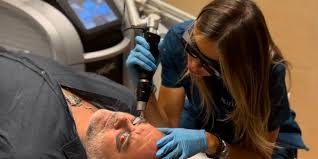 IML Clinic, primera Clínica en contar con 2 láseres de picosegundos