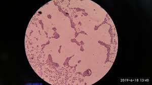 Image result for Staphylococcus Saprophyticus