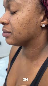 Skintech Spa Reviews