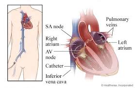 Pin On Heart Rhythms